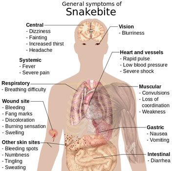 Snake Bite Symptoms