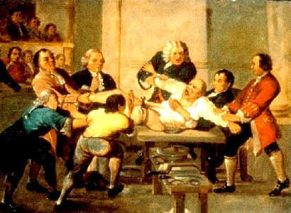 Amputation with Six Assistants