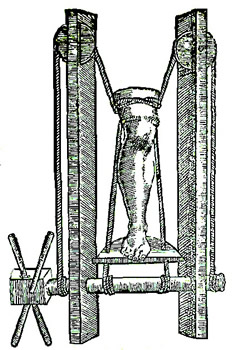 Ambroise Pare's Fracture Extension Machine