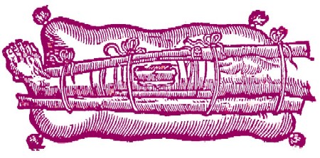 Leg Fracture with Long Splints