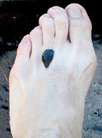 Leech attached to a foot
