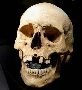 Skull with Obol In Its Mouth