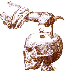 Trepanning a Skull, Woodall